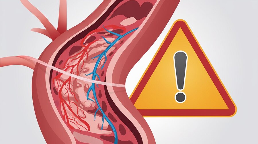 Riscos e Precauções da Hipertrofia Metabólica